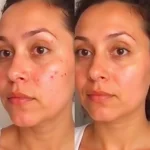 syleora clear pulse ultrasonic skin scrubber before after compare customer 5